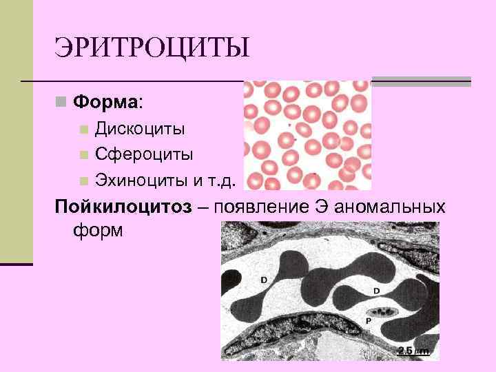 ЭРИТРОЦИТЫ n Форма: n Дискоциты n Сфероциты n Эхиноциты и т. д. Пойкилоцитоз –