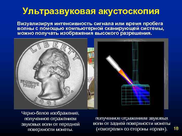 Ультразвуковая акустоскопия Визуализируя интенсивность сигнала или время пробега волны с помощью компьютерной сканирующей системы,