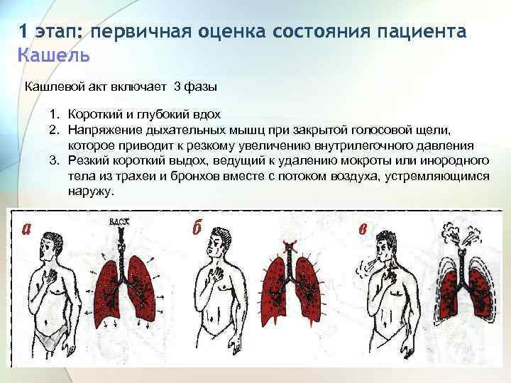 1 этап: первичная оценка состояния пациента Кашель Кашлевой акт включает 3 фазы 1. Короткий