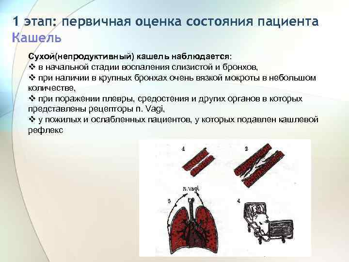 1 этап: первичная оценка состояния пациента Кашель Сухой(непродуктивный) кашель наблюдается: v в начальной стадии