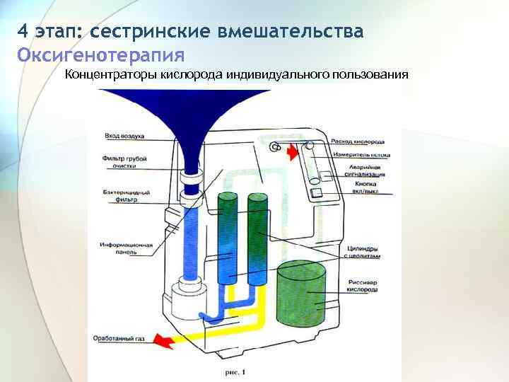 4 этап: сестринские вмешательства Оксигенотерапия Концентраторы кислорода индивидуального пользования 