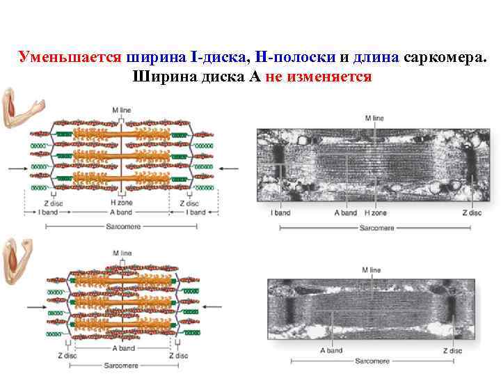 Уменьшается ширина I-диска, H-полоски и длина саркомера. Ширина диска А не изменяется 