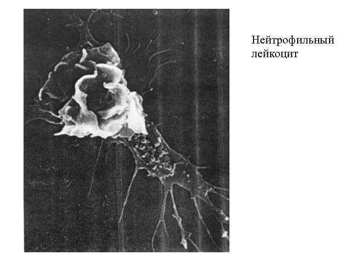 Нейтрофильный лейкоцит 