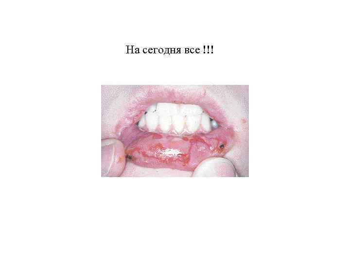 На сегодня все !!! 