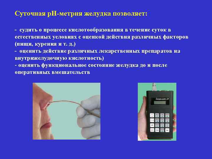 Суточная р. Н-метрия желудка позволяет: - судить о процессе кислотообразования в течение суток в
