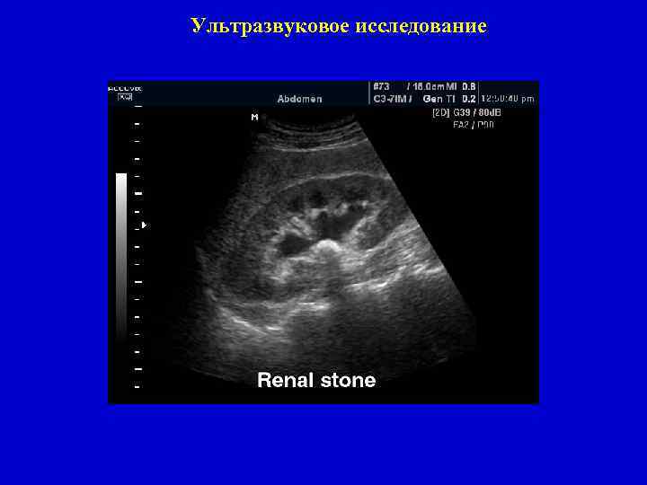 Ультразвуковое исследование 