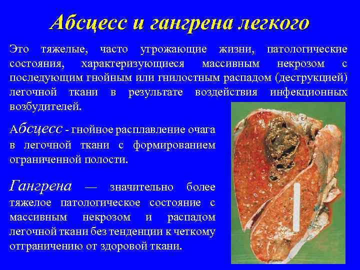 Абсцесс и гангрена легкого Это тяжелые, часто угрожающие жизни, патологические состояния, характеризующиеся массивным некрозом
