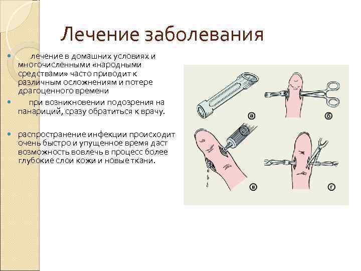 Лечение заболевания лечение в домашних условиях и многочисленными «народными средствами» часто приводит к различным