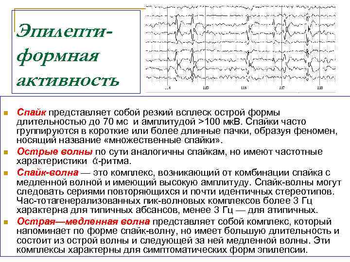 Индекс эпилептиформной активности. Острая волна медленная волна на ЭЭГ. Региональная эпилептиформная активность. Острые волны на ЭЭГ. Субклиническая региональная эпилептиформная активность что это.