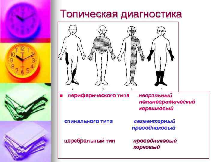 Топическая диагностика n периферического типа невральный полиневритический корешковый спинального типа сегментарный проводниковый церебральный тип