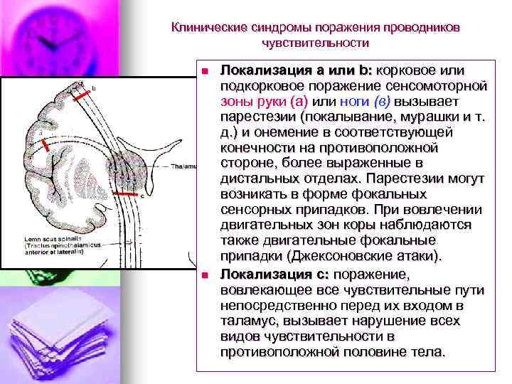 Клинические синдромы поражения проводников чувствительности n n Локализация а или b: корковое или подкорковое