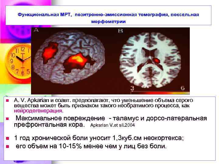 Функциональная МРТ, позитронно-эмиссионная томография, воксельная морфометрии n n А. V. Apkariап и соавт. предполагают,