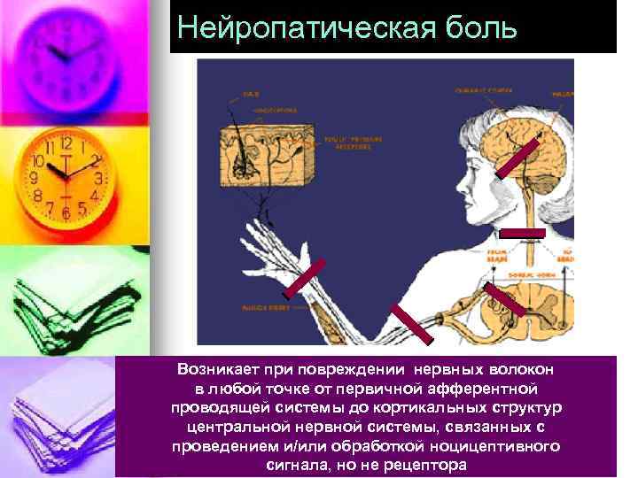 Нейропатическая боль Возникает при повреждении нервных волокон в любой точке от первичной афферентной проводящей