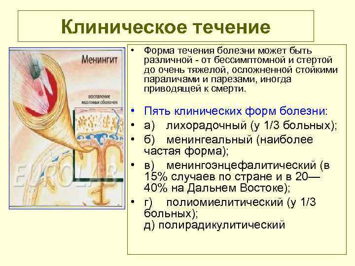 Клиническое течение • Форма течения болезни может быть различной от бессимптомной и стертой до