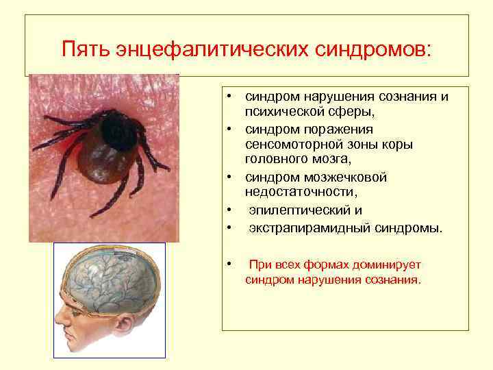 Пять энцефалитических синдромов: • синдром нарушения сознания и психической сферы, • синдром поражения сенсомоторной