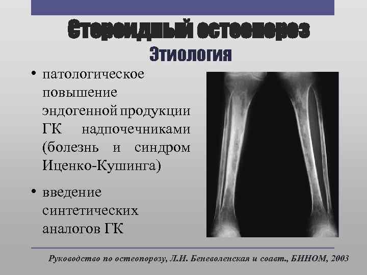 Наследственная остеодистрофия альбрехта презентация