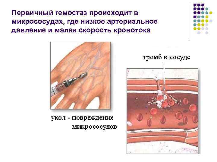 Гемостаз ригевидоном схема