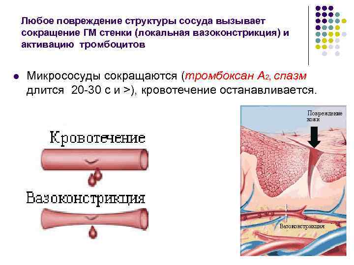 Какой сосуд поврежден на рисунке 1