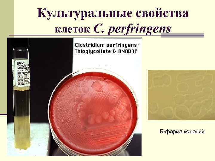 Культуральные свойства клеток C. perfringens R-форма колоний 