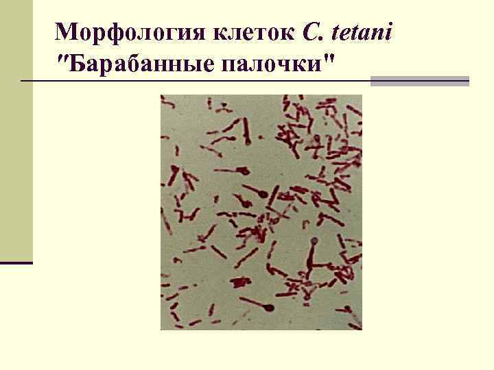 Морфология клеток C. tetani "Барабанные палочки" 