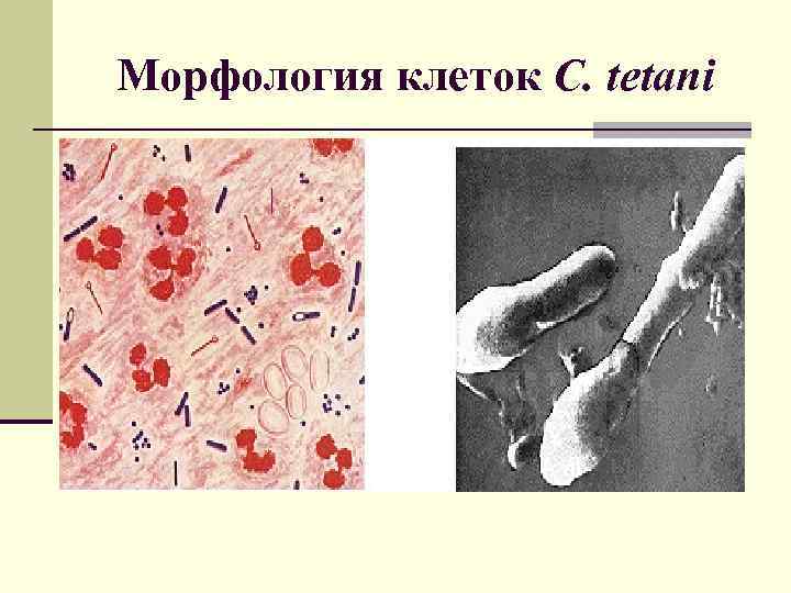 Морфология клеток C. tetani 