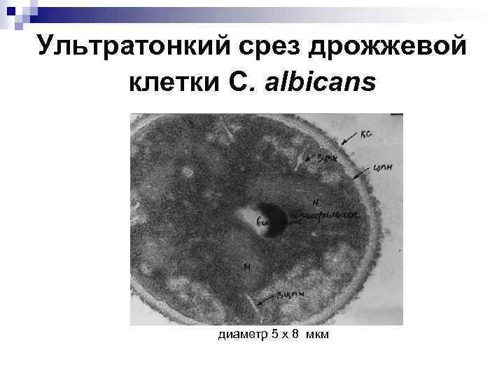 Ультратонкий срез дрожжевой клетки С. albicans диаметр 5 х 8 мкм 