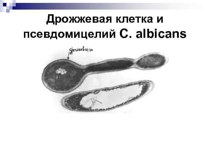 Дрожжевая клетка и псевдомицелий C. albicans 