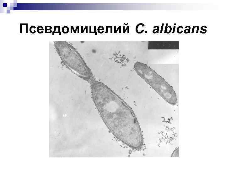 Псевдомицелий C. albicans 