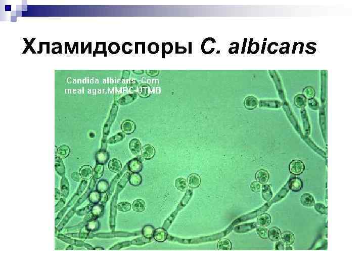 Хламидоспоры C. albicans 