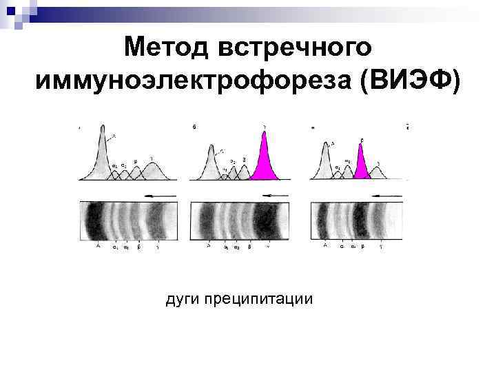 Метод встречного иммуноэлектрофореза (ВИЭФ) дуги преципитации 
