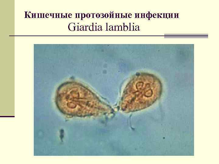 Кишечные протозойные инфекции Giardia lamblia 