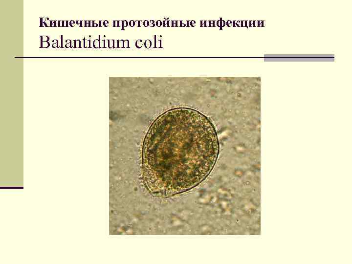 Кишечные протозойные инфекции Balantidium coli 