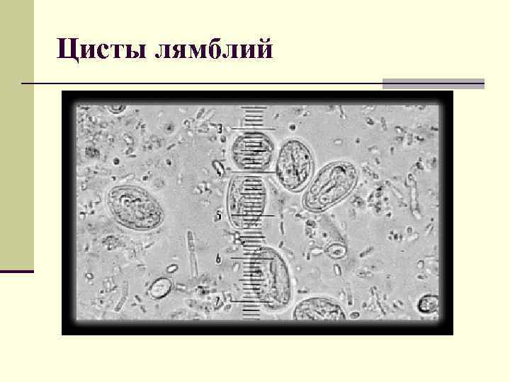 Цисты лямблий 