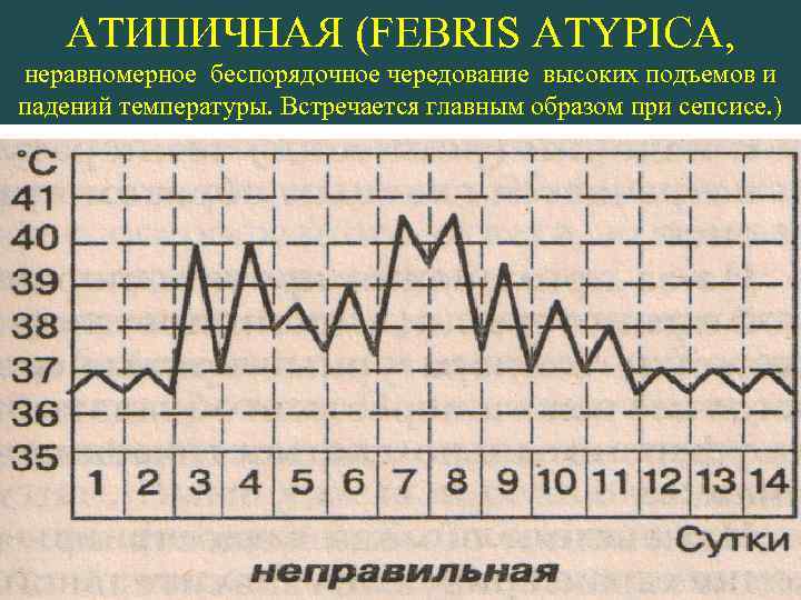 АТИПИЧНАЯ (FEBRIS ATYPICA, неравномерное беспорядочное чередование высоких подъемов и падений температуры. Встречается главным образом