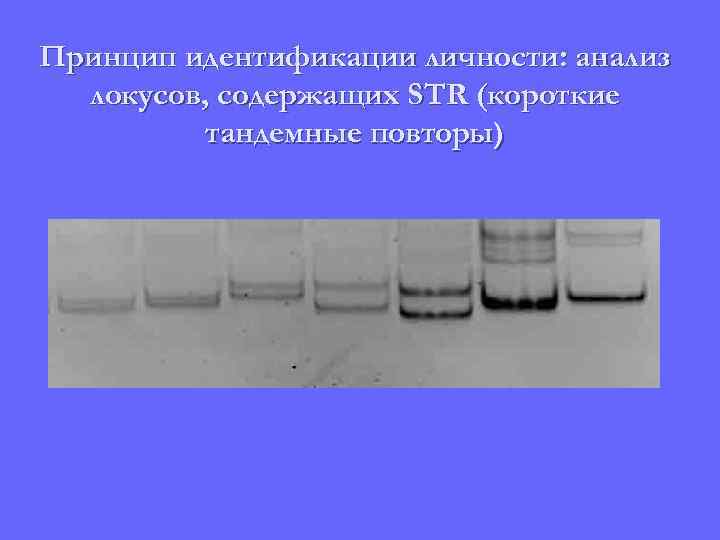 Принцип идентификации личности: анализ локусов, содержащих STR (короткие тандемные повторы) 