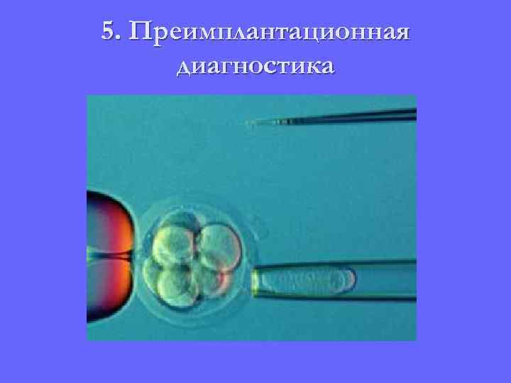 5. Преимплантационная диагностика 