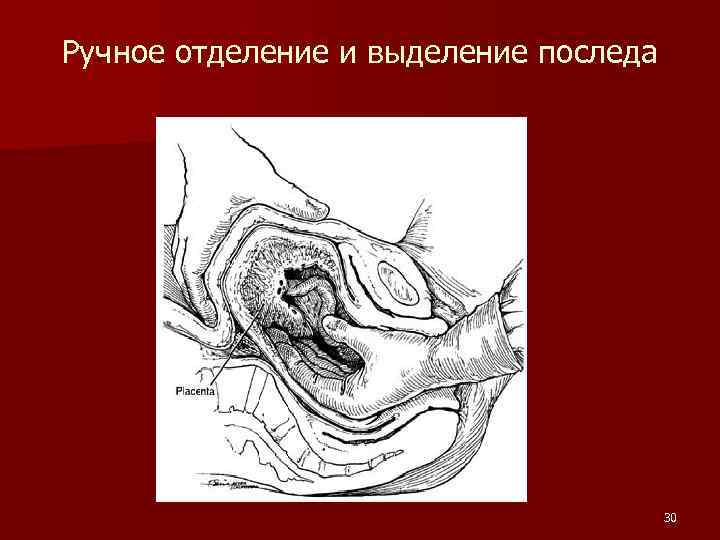 Отделение последа у коровы схема