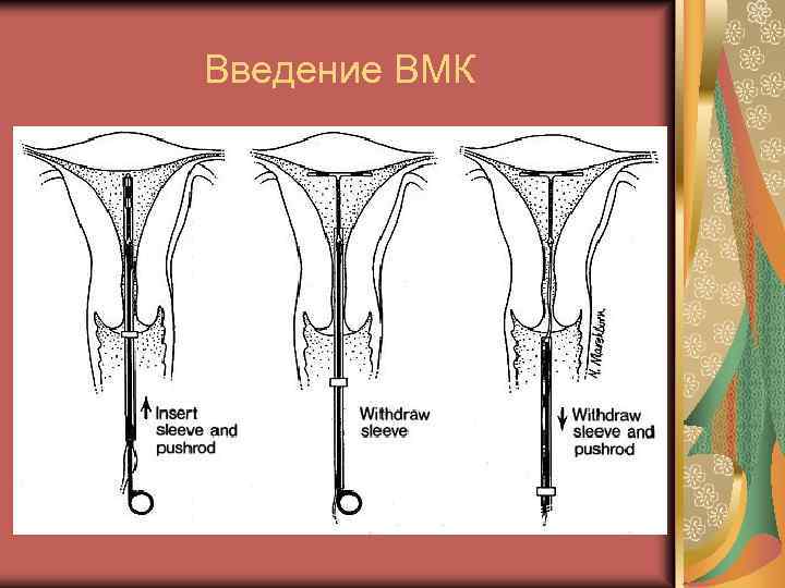 Карта вмк что это