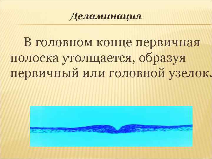 Деламинация В головном конце первичная полоска утолщается, образуя первичный или головной узелок. 