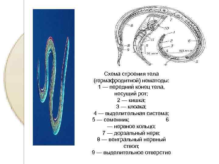 Ротовое отверстие червя. Схема строения тела (гермафродитной) нематоды. Класс круглых червей нематоды. Нематоды - Первичнополостные черви. Кольчатые черви класс нематоды.