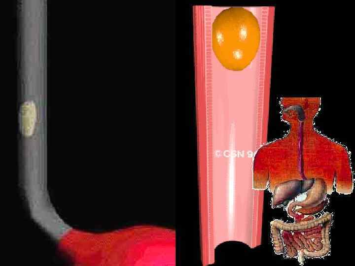 Пищевод – это мышечная трубка. ( L= 25 см. ) Пищевод 