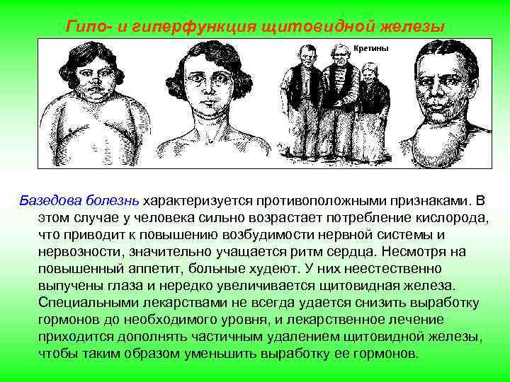 Гипо- и гиперфункция щитовидной железы Базедова болезнь характеризуется противоположными признаками. В этом случае у