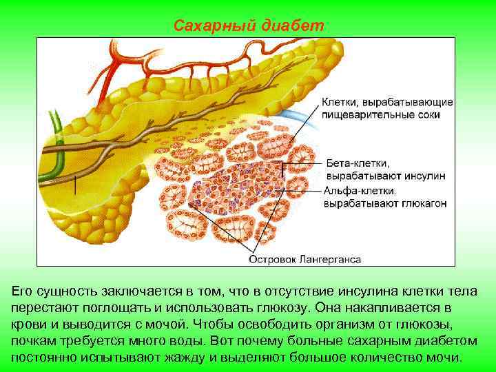 Сахарный диабет Его сущность заключается в том, что в отсутствие инсулина клетки тела перестают