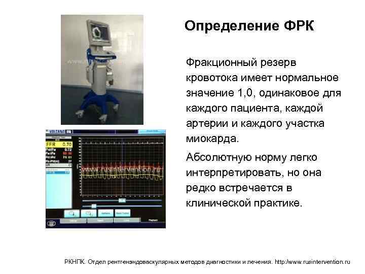 Измерение кровотока. Фракционный резерв кровотока методика. Измерение фракционного резерва коронарного кровотока. ФРК фракционный резерв кровотока. Коронарный резерв кровотока.