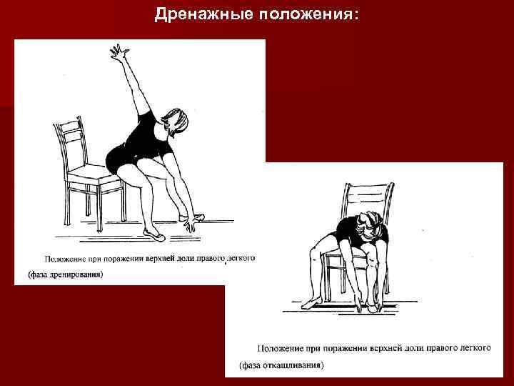 Дренажные положения: 