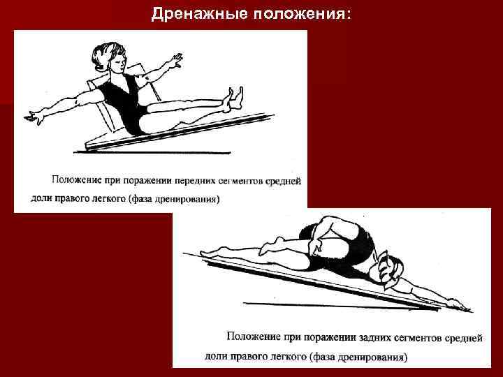 Дренажные положения: 