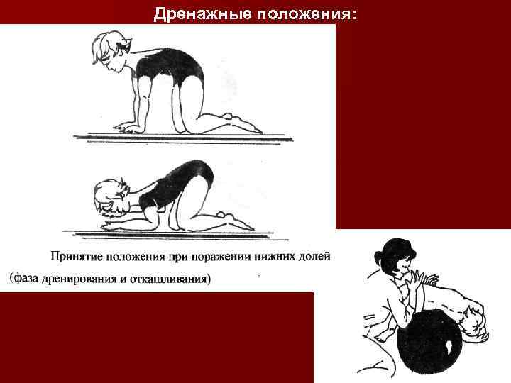 Дренажные положения: 