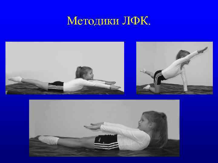 Методики ЛФК. 