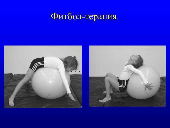 Фитбол-терапия. 