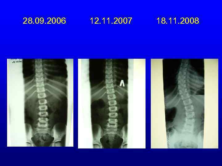 28. 09. 2006 12. 11. 2007 18. 11. 2008 